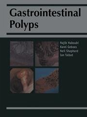 Gastrointestinal Polyps - Haboubi, Y. / Geobes, Karel / Shepherd, A. / Talbot, C. (eds.)