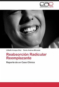 Reabsorción Radicular Reemplazante