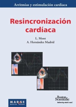 Resincronización cardíaca - Hernández Madrid, Antonio; Mont Girbau, Josep Lluís