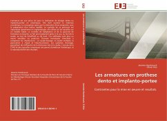 Les armatures en prothese dento et implanto-portee - Hombrouck, Jeremie;Hüe, Olivier