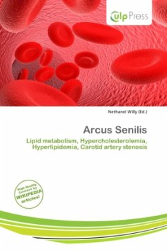 Arcus Senilis