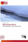Microwave Burn Microwave Burn