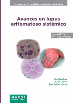 Avances en lupus eritematoso sistémico - Jiménez Alonso, Juan; Cervera, Ricard