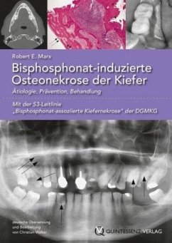 Bisphosphonat-induzierte Osteonekrose der Kiefer - Marx, Robert E.
