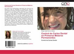 Control de Caries Dental en Primeros Molares Permanentes - Carrero Gómez, Gladys Isabel