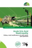 Acute Uric Acid Nephropathy Acute Uric Acid Nephropathy
