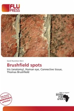 Brushfield spots