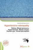Hypertensive retinopathy