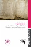 Hypoplasia