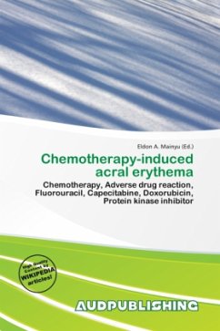 Chemotherapy-induced acral erythema