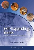 Self-Expanding Stents in Gastrointestinal Endoscopy