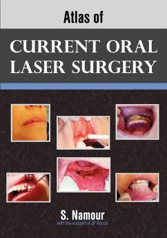 Atlas of Current Oral Laser Surgery - Namour, S.