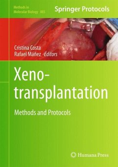 Xenotransplantation