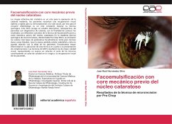 Facoemulsificación con core mecánico previo del núcleo cataratoso - Hernández Silva, Juan Raúl