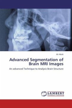 Advanced Segmentation of Brain MRI Images