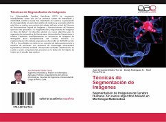 Técnicas de Segmentación de Imágenes - Valdés Torres, José Armando;Rodríguez G., Sandy;Pérez Pérez, Noel