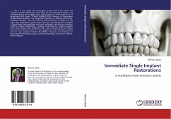 Immediate Single Implant Restorations - Atieh, Momen