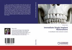 Immediate Single Implant Restorations