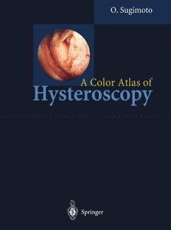A Color Atlas of Hysteroscopy - Sugimoto, Osamu