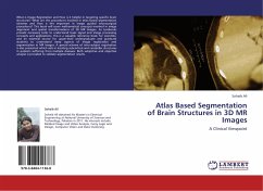 Atlas Based Segmentation of Brain Structures in 3D MR Images