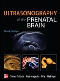 Ultrasonography of the Prenatal Brain