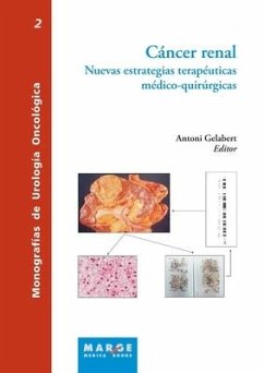 Cáncer renal - Gelabert Mas, Antoni