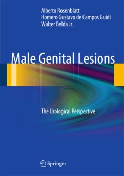 Male Genital Lesions - Rosenblatt, Alberto;de Campos Guidi, Homero Gustavo;Belda Jr., Walter