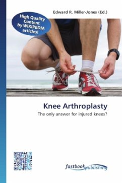 Cover Knee Arthroplasty