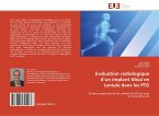 Evaluation radiologique d¿un implant tibial en tantale dans les PTG