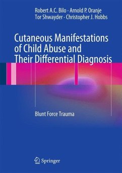 Cutaneous Manifestations of Child Abuse and Their Differential Diagnosis - Bilo, Robert A. C.;Oranje, Arnold P.;Shwayder, Tor