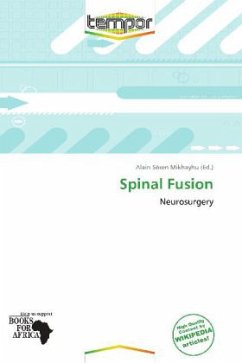 Spinal Fusion