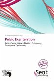 Pelvic Exenteration