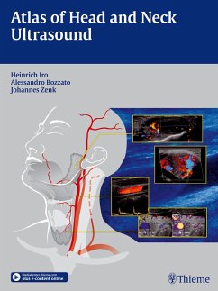 Atlas of Head and Neck Ultrasound - Iro, Heinrich;Bozzato, Alessandro;Zenk, Johannes