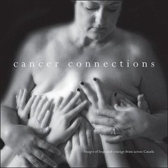 Cancer Connections: Images of Hope and Courage Across Canada - Burns, James, Jr.