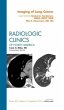 Imaging of Lung Cancer, an Issue of... - Bild 1