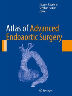 Atlas of Advanced Endoaortic Surgery