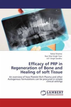 Efficacy of PRP in Regeneration of Bone and Healing of soft Tissue - Sharma, Rahul;Toor, Ravi Sher Singh;Sandhu, A.P. Singh