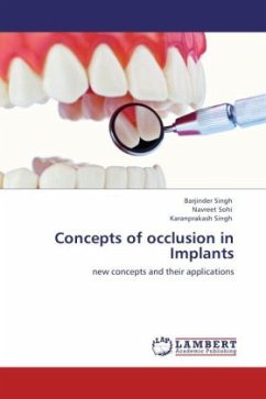 Concepts of occlusion in Implants - Singh, Barjinder;Sohi, Navreet;Singh, Karanprakash