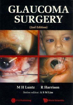 Glaucoma Surgery (2nd Edition) - Luntz, Maurice H; Harrison, Raymond