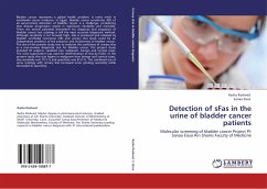 Detection of sFas in the urine of bladder cancer patients