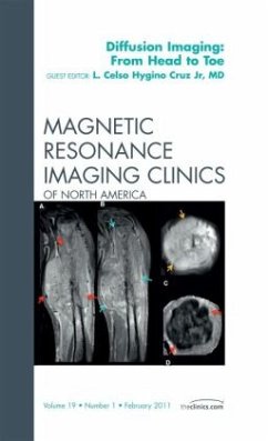 Clinical Applications of Diffusion Imaging: from Head to Toe, An Issue of Magnetic Resonance Imaging Clinics - Hygino, Celso