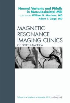 Normal Variants and Pitfalls in Musculoskeletal MRI, An Issue of Magnetic Resonance Imaging Clinics - Morrison, William B.;Zoga, Adam C.