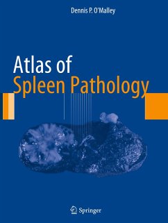 Atlas of Spleen Pathology - O'Malley, Dennis P.