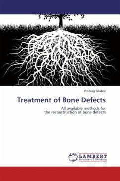 Treatment of Bone Defects - Grubor, Predrag