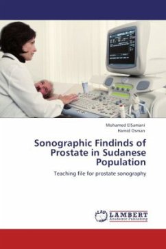 Sonographic Findinds of Prostate in Sudanese Population