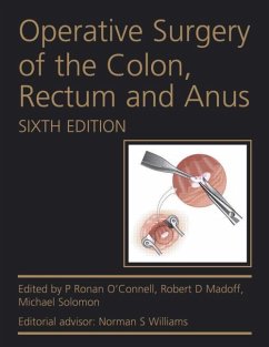Operative Surgery of the Colon, Rectum and Anus - O'Connell, P Ronan; Madoff, Robert D; Solomon, Michael