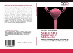 Aplicación de la Radiocirugía en Adolescentes - Torriente Hernández, Santa Beatriz