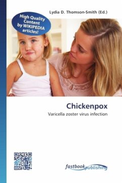 Chickenpox