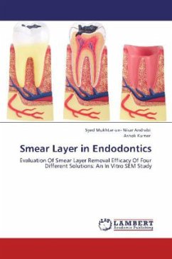 Smear Layer in Endodontics - Andrabi, Syed Mukhtar-un- Nisar;Kumar, Ashok