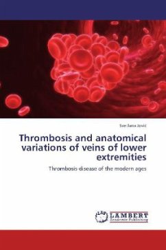 Thrombosis and anatomical variations of veins of lower extremities